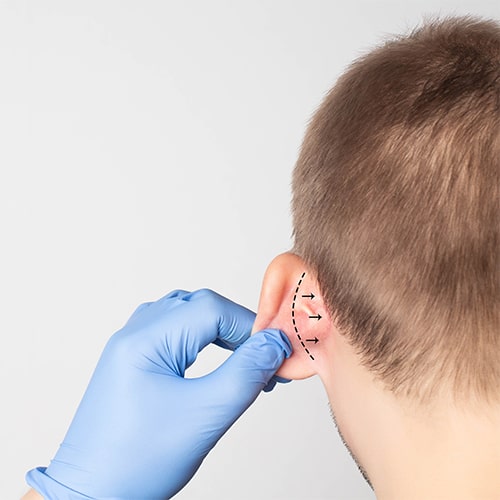 Yılan Yapısı 1520636014