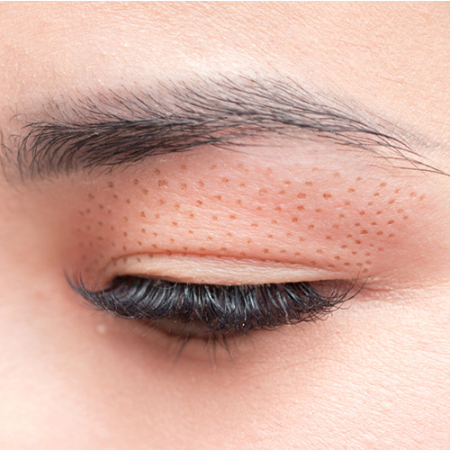 Yılan Yapısı 956782655