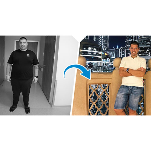 Yılan Yapısı 830644554