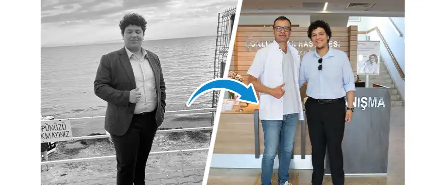 С помощта на бариатрична хирургия пациентът ни отслабна с цели 47 килограма!