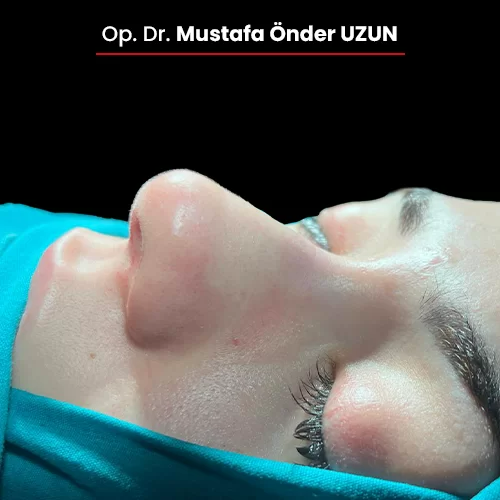 Öncesi Sonrası 1599461963