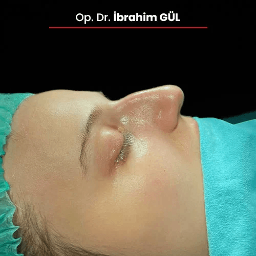 Öncesi Sonrası 123985098