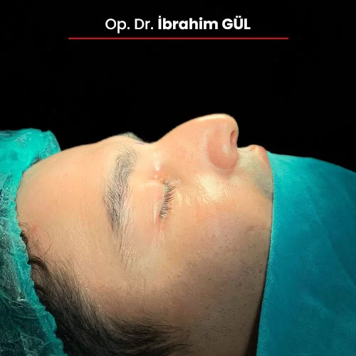 Öncesi Sonrası 907218330