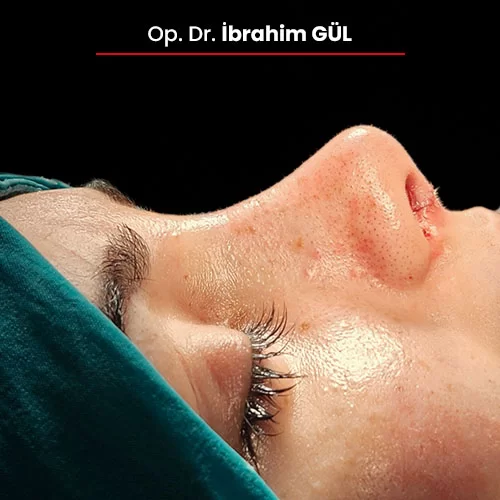 Öncesi Sonrası 1331535300