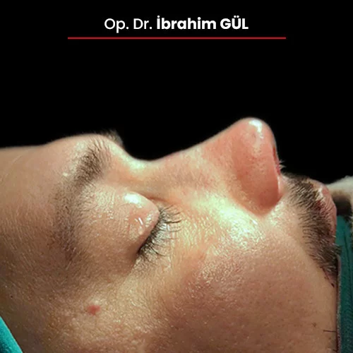 Öncesi Sonrası 1260754217