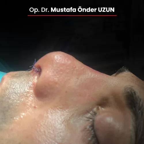 Öncesi Sonrası 670659560