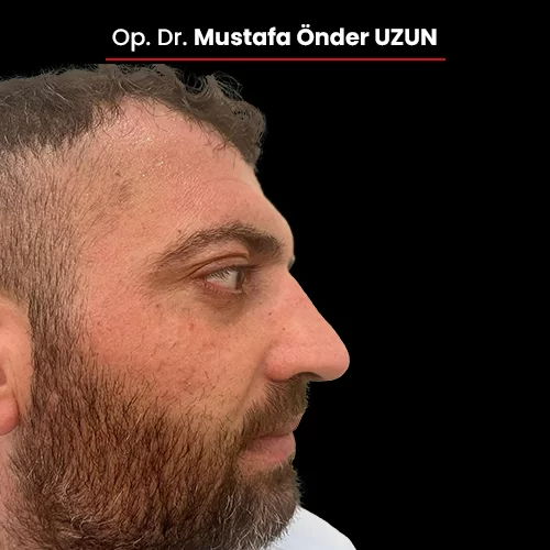 Öncesi Sonrası 2140687231