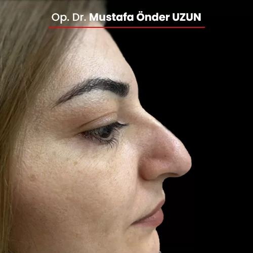 Öncesi Sonrası 797548293