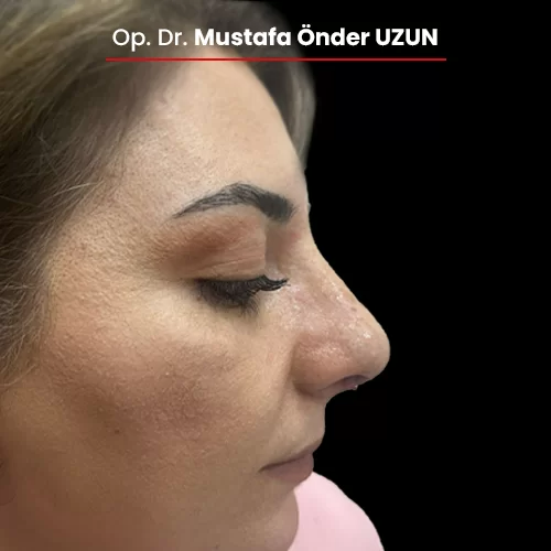 Öncesi Sonrası 797548293