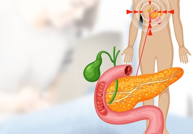 Ендоскопска ретроградна холангиопанкреатография (ERCP) Съвременен метод за диагностика и лечение на заболявания на жлъчната система, панкреаса и черния дроб