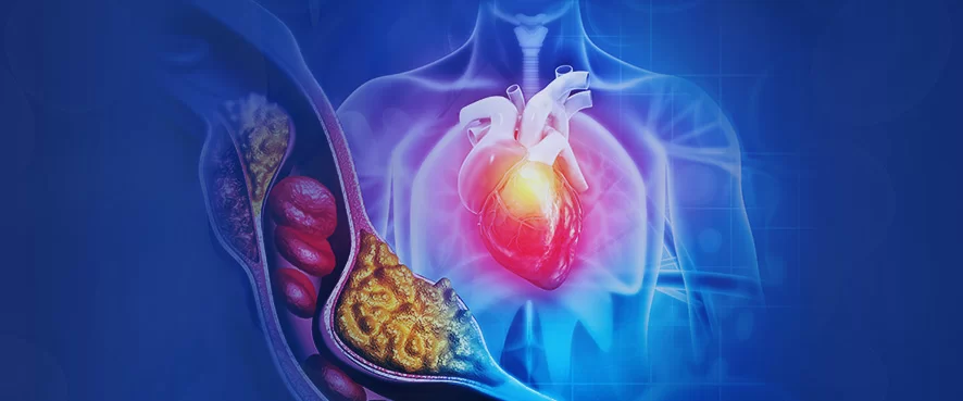 „Холестерол“: враг или верен приятел на тялото ни?