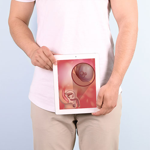 Рак на тестисите