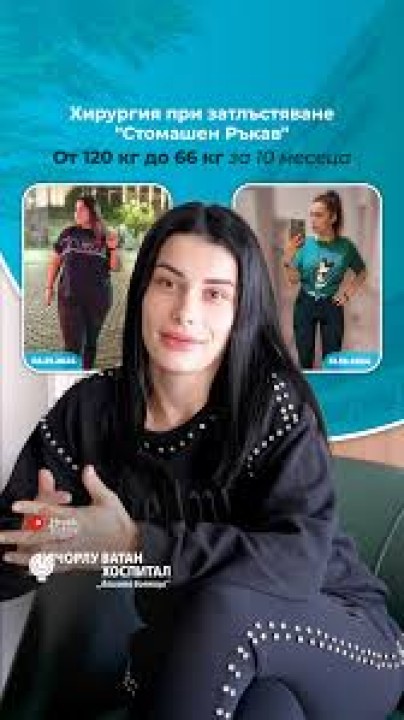 Хирургия при затлъстяване "Стомашен Ръкав"От 120 кг до 66 кг за 10 месеца